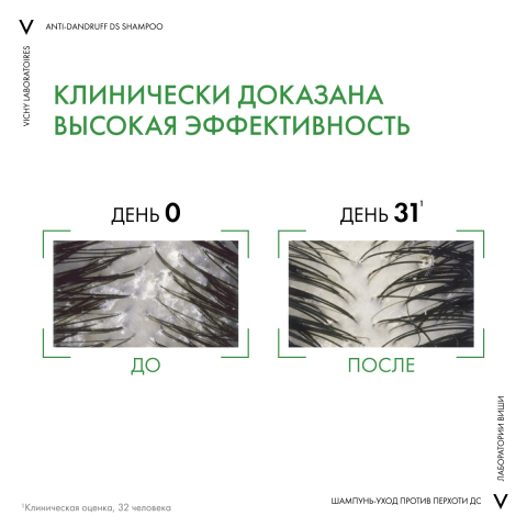 Dercos Интенсивный Шампунь-уход против перхоти для жирных и нормальных волос, 390 мл, VICHY